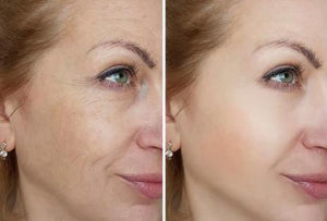 Light Therapy + Facial Toning